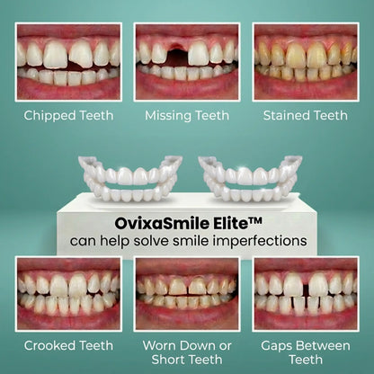 OvixaSmile Elite™